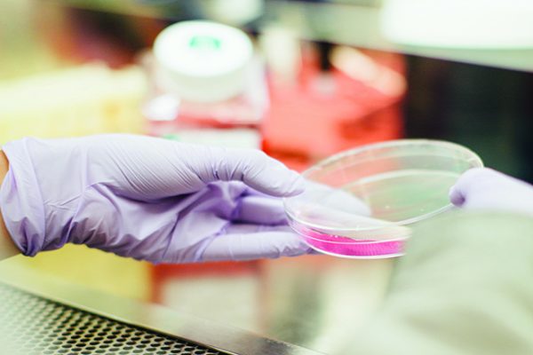 salmonella drew-hays-tGYrlchfObE-unsplash